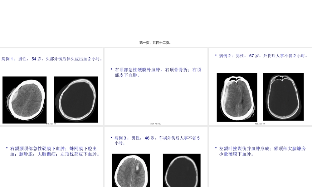 头颈部外伤病例常见病、多发病(1).pptx