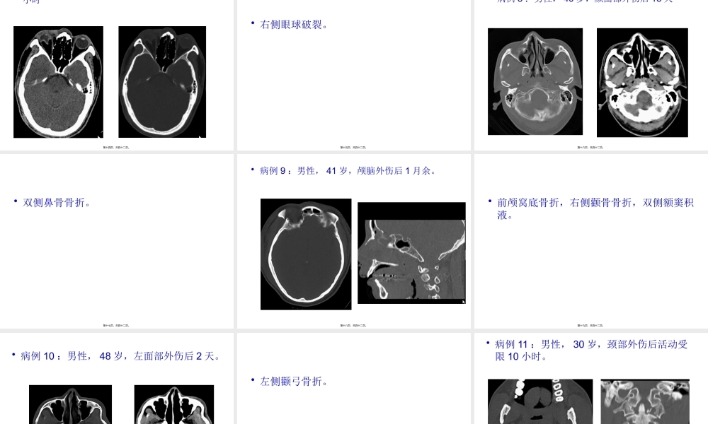 头颈部外伤病例常见病、多发病(1).pptx