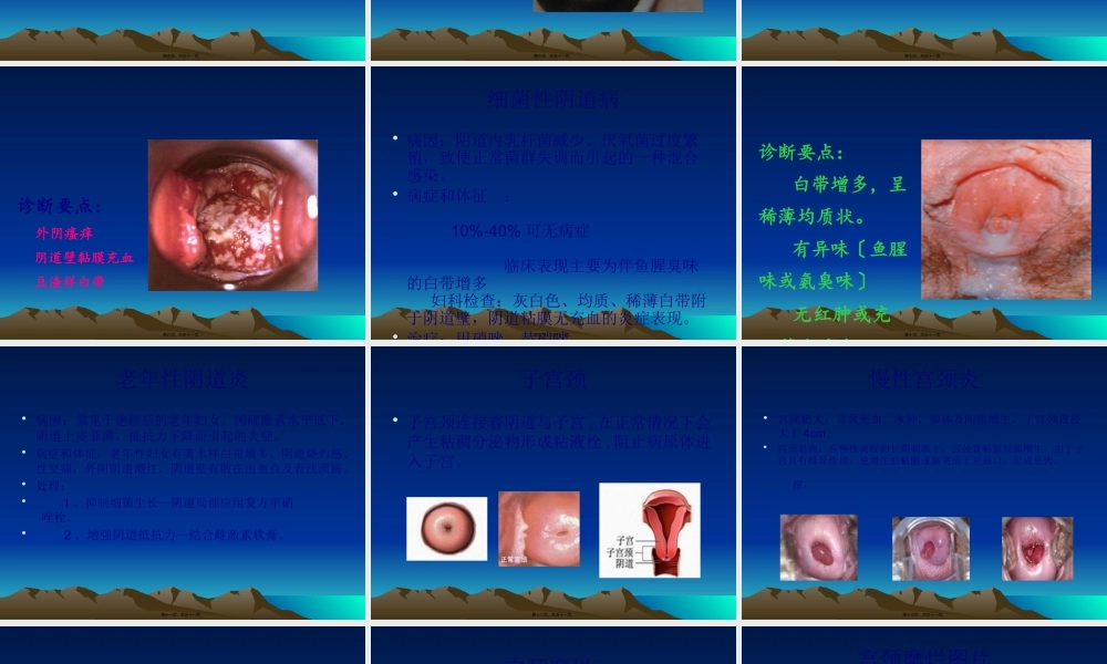 妇科常见病知识讲座(1).pptx