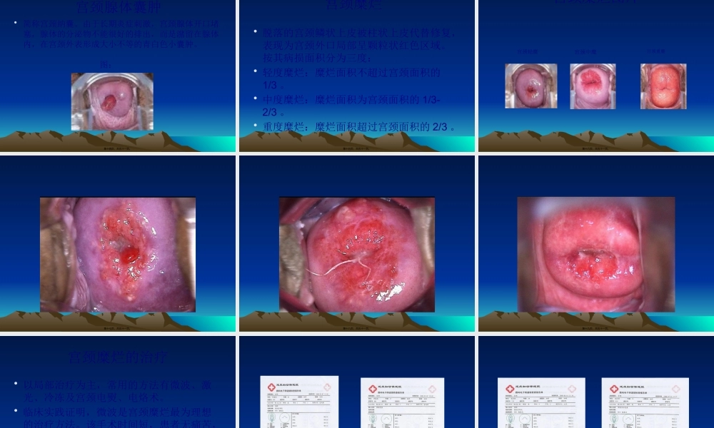 妇科常见病知识讲座(1).pptx