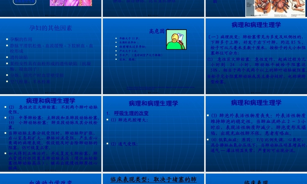 妊娠与肺栓塞-(1)(1).pptx