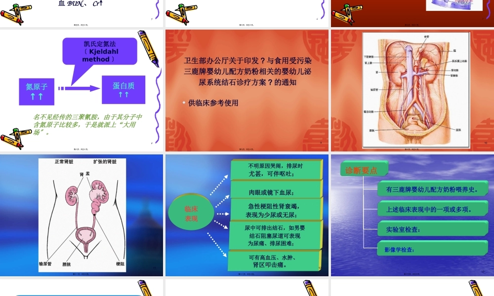 婴幼儿泌尿系统结石.(1).pptx