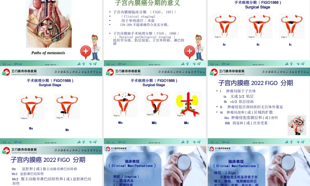 子宫内膜癌症张利娜(1).pptx