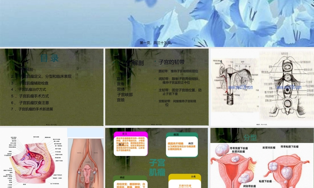 子宫肌瘤+PPT(修改)(1).pptx