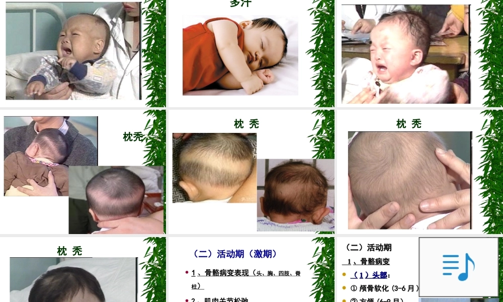 小儿营养性维生素D缺乏症(1).ppt