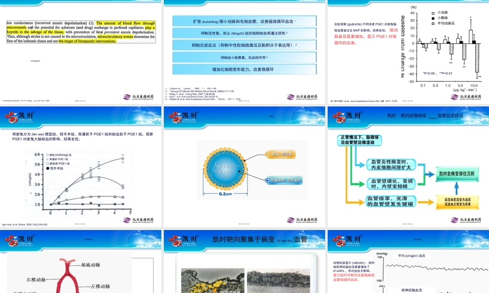 2022年医学专题—缺血性卒中及微循环(1).ppt