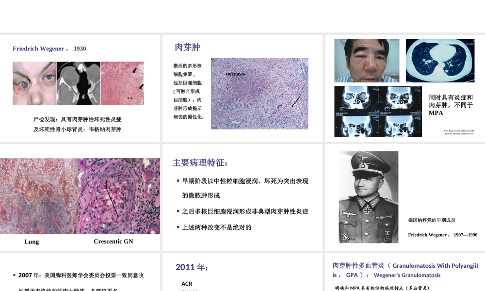 系统性血管炎2013(1).ppt