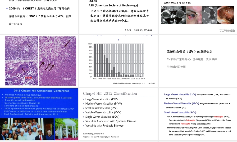 系统性血管炎2013(1).ppt