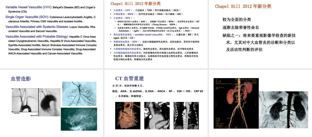 系统性血管炎2013(1).ppt