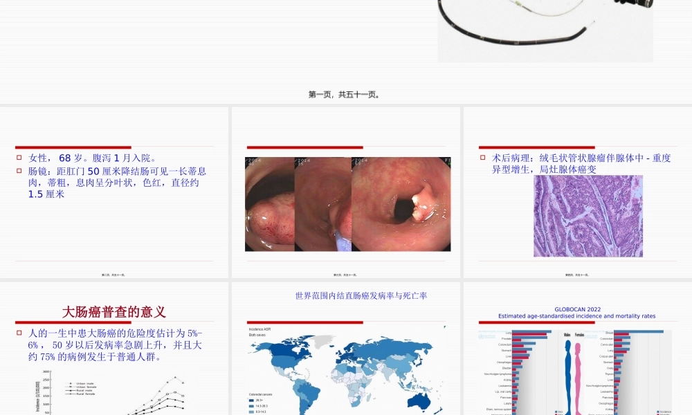 大肠癌普查与随访(1).pptx