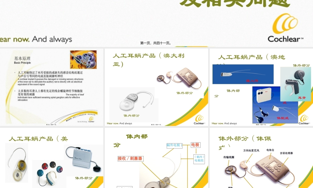 人工耳蜗工作原理(1).pptx