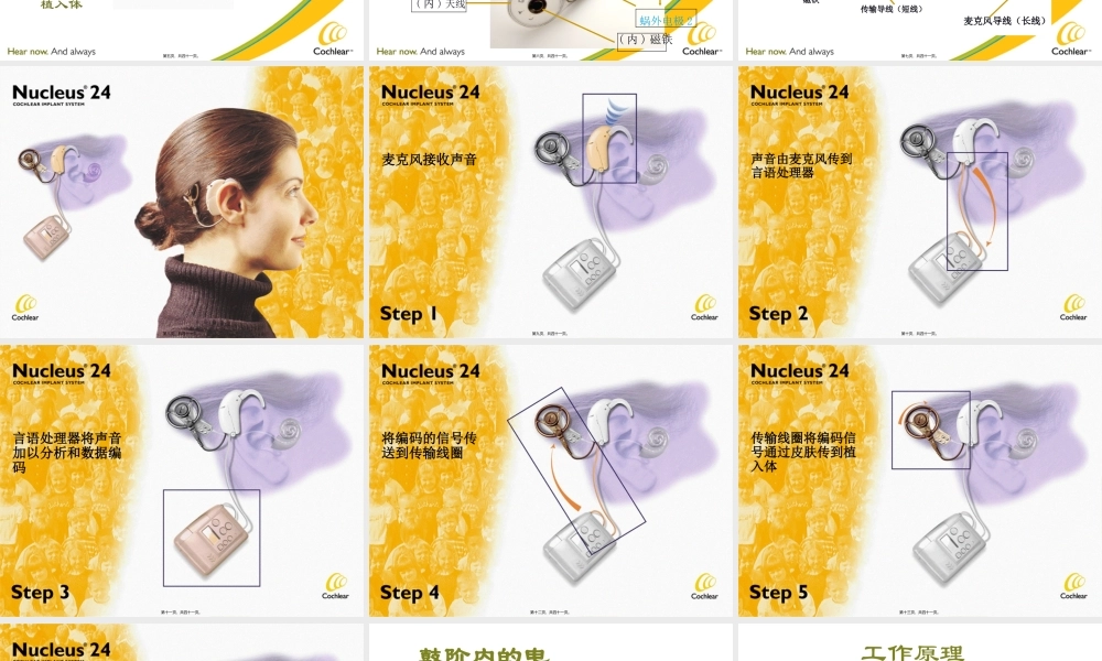 人工耳蜗工作原理(1).pptx