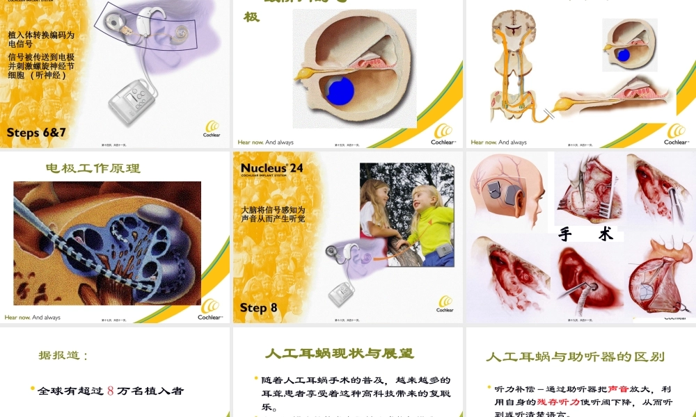 人工耳蜗工作原理(1).pptx
