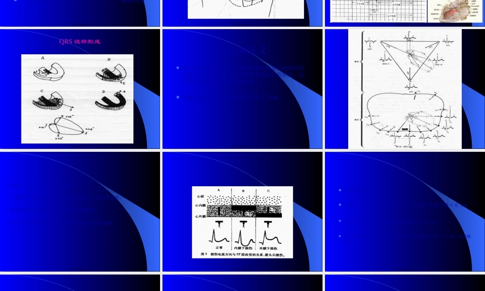 冠心病心电图(1).pptx