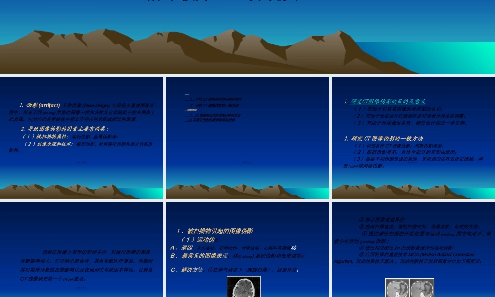 2022年医学专题—医用CT图像伪影成因(1).ppt
