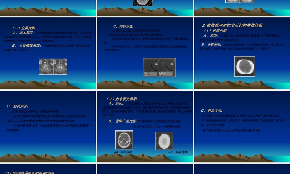 2022年医学专题—医用CT图像伪影成因(1).ppt