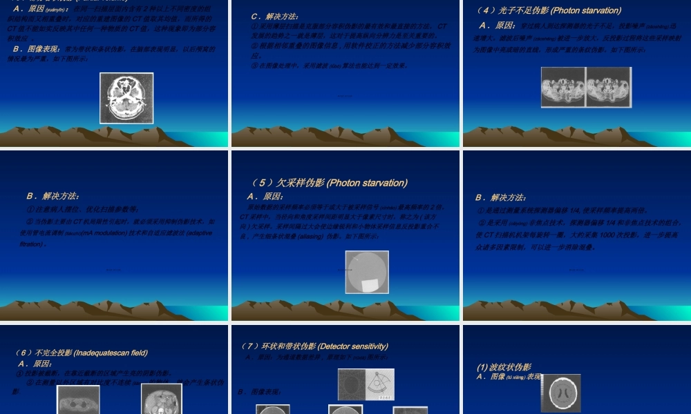 2022年医学专题—医用CT图像伪影成因(1).ppt