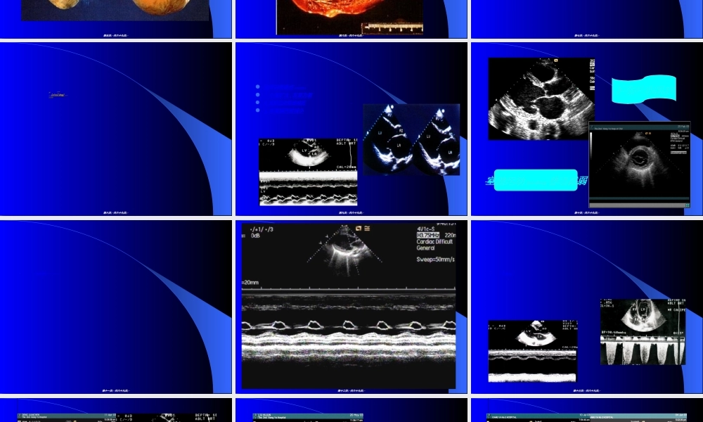 2022年医学专题—原发性心肌病变2008(1).ppt
