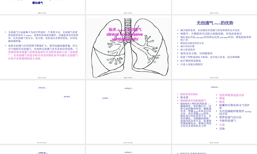 2022年医学专题—无创呼吸机介绍(1).ppt