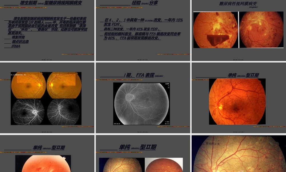 2022年医学专题—糖尿病性视网膜病变2014年(1).ppt