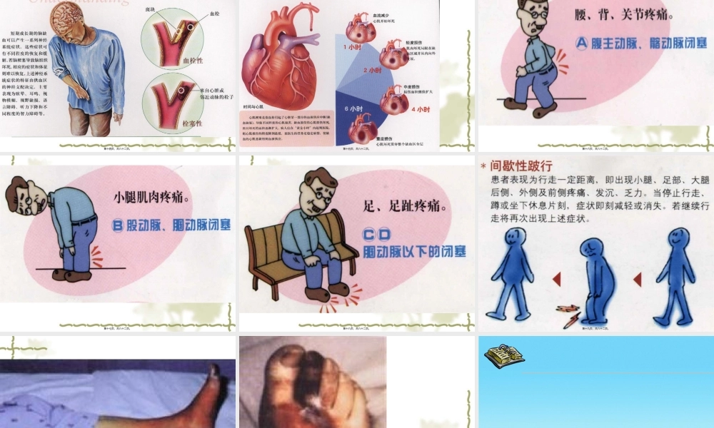 2022年医学专题—糖尿病慢性并发症的防治(2013-12-07继教会议用)(1).ppt