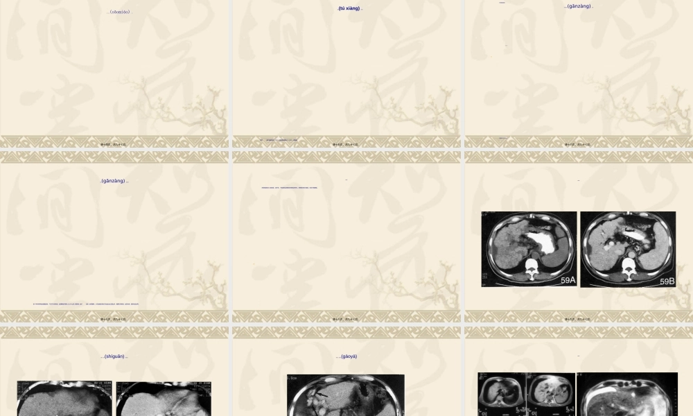 2022年医学专题—影像学-肝胰脾病变的CT和MRI(1).ppt