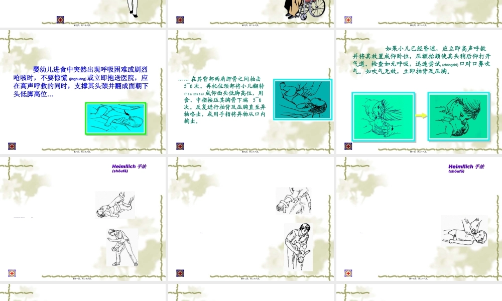 2022年医学专题—气管异物梗塞急救(27)(1).ppt