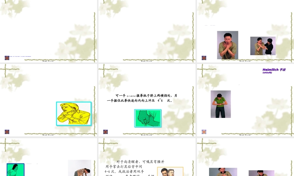 2022年医学专题—气管异物梗塞急救(27)(1).ppt