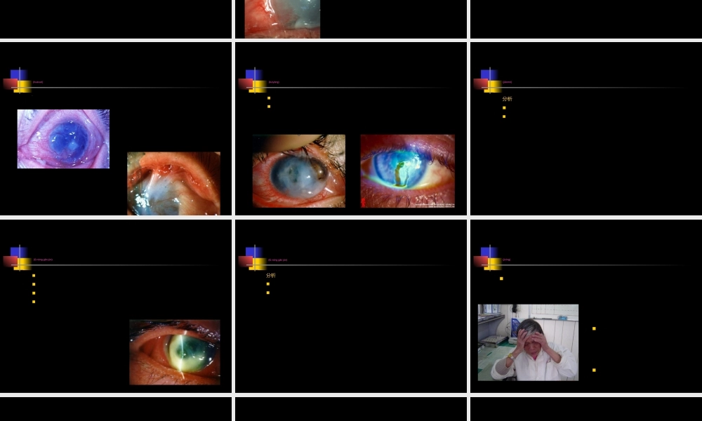2022年医学专题—眼科十大急症(1).ppt