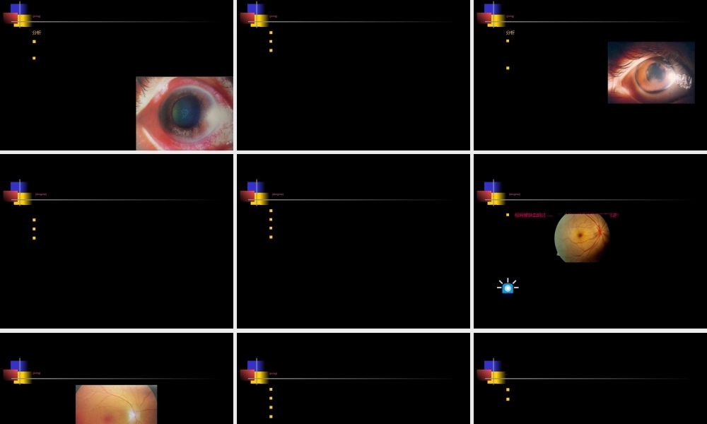 2022年医学专题—眼科十大急症(1).ppt