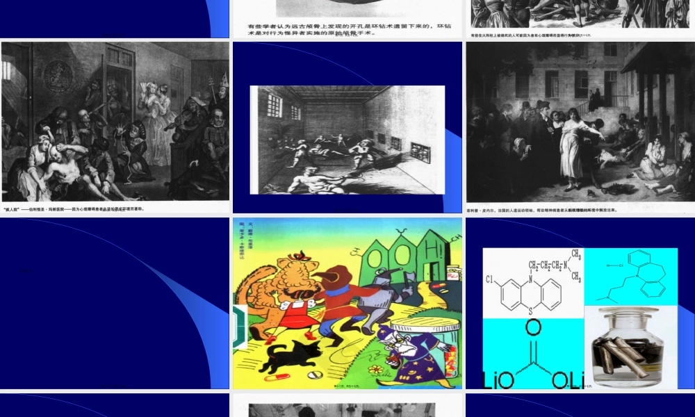 2022年医学专题—平衡康复(1).ppt