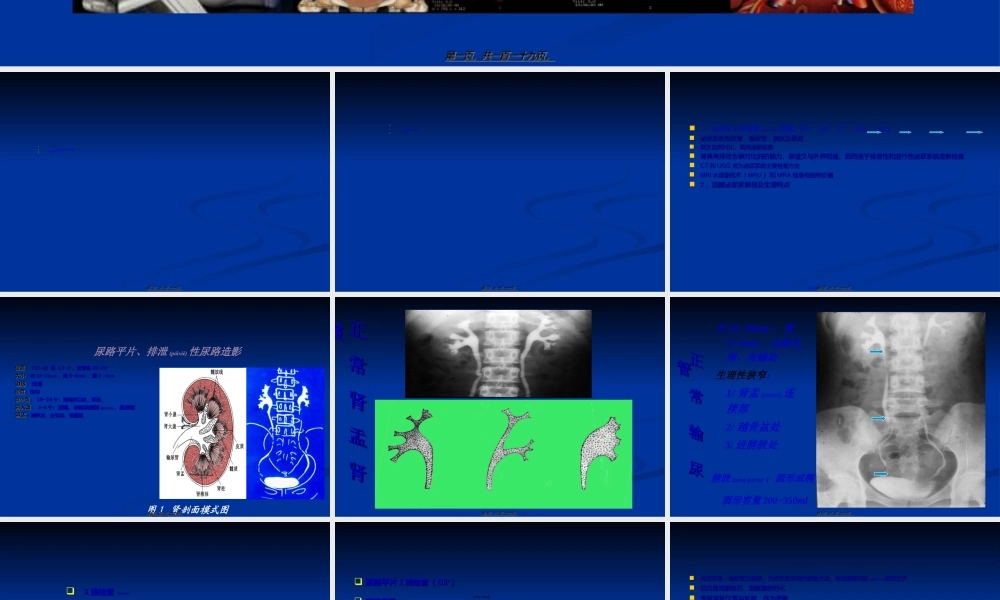 2022年医学专题—影像学——泌尿系统PPT(1).ppt