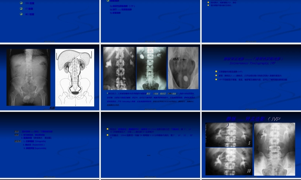 2022年医学专题—影像学——泌尿系统PPT(1).ppt