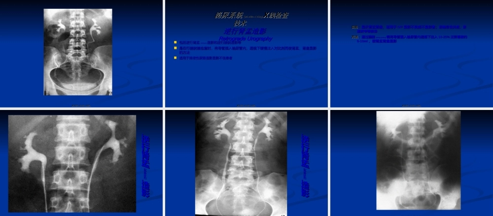 2022年医学专题—影像学——泌尿系统PPT(1).ppt