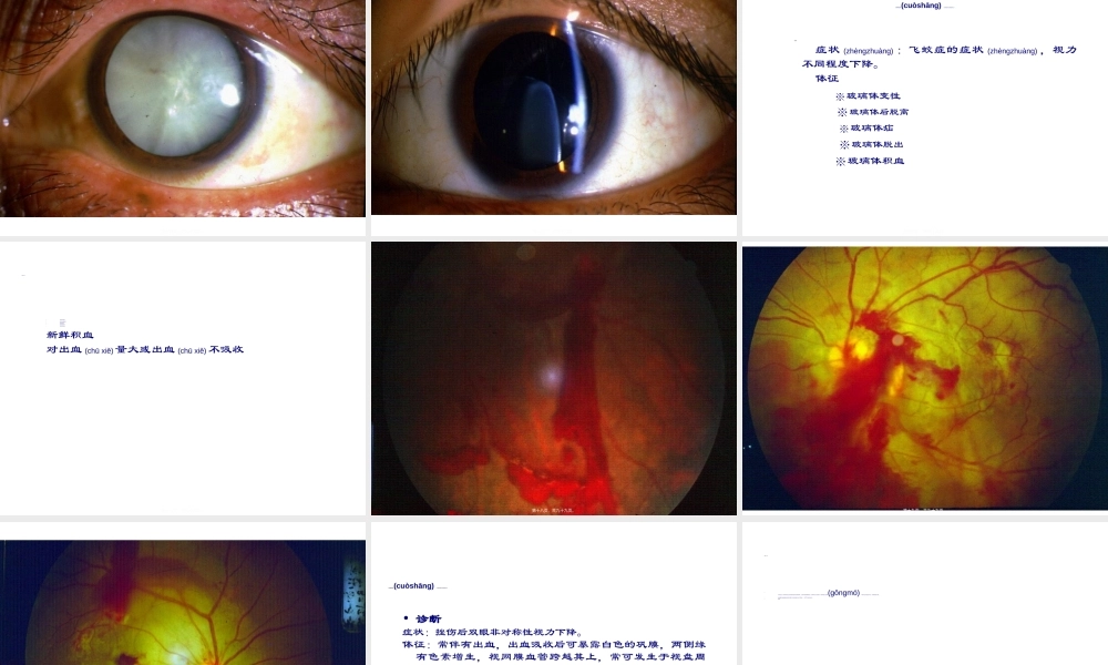 2022年医学专题—眼外伤诊疗常规(1).ppt