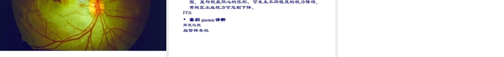 2022年医学专题—眼外伤诊疗常规(1).ppt