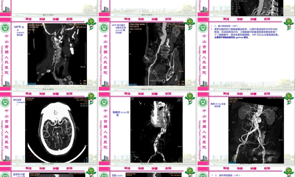 2022年医学专题—新-多层螺旋CT血管成像(CTA)(1).ppt