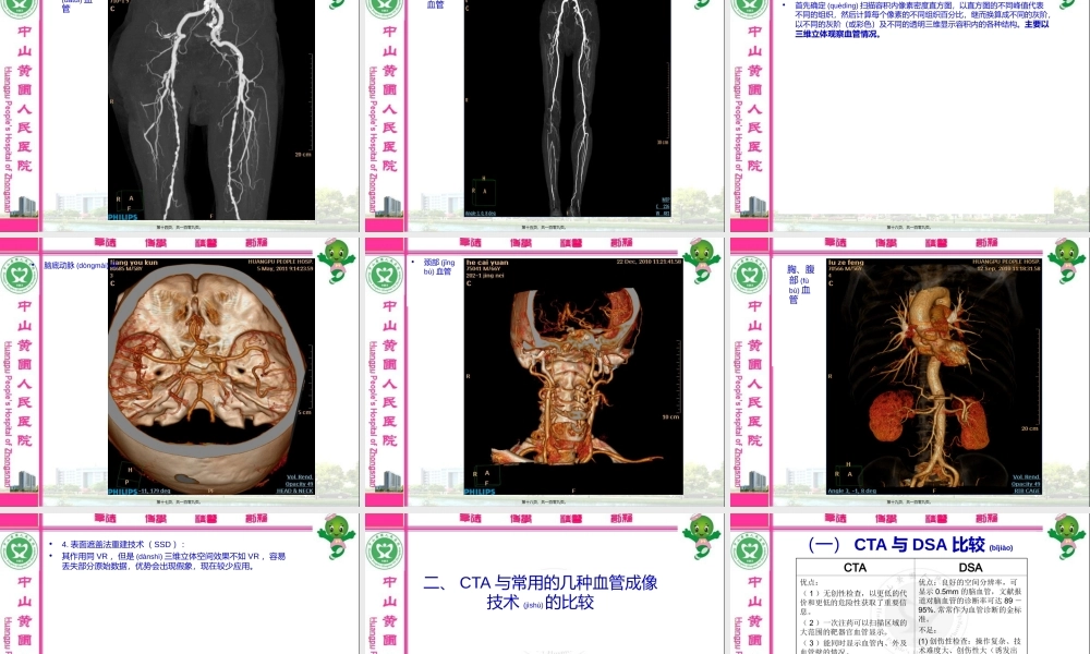 2022年医学专题—新-多层螺旋CT血管成像(CTA)(1).ppt