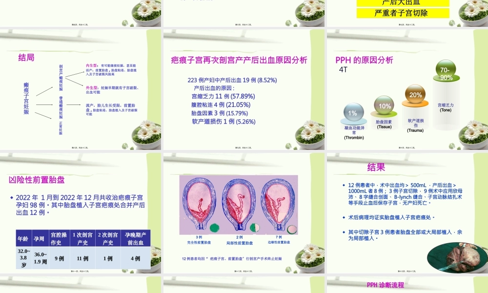 产后出血指南2014-镇海2015(1).pptx