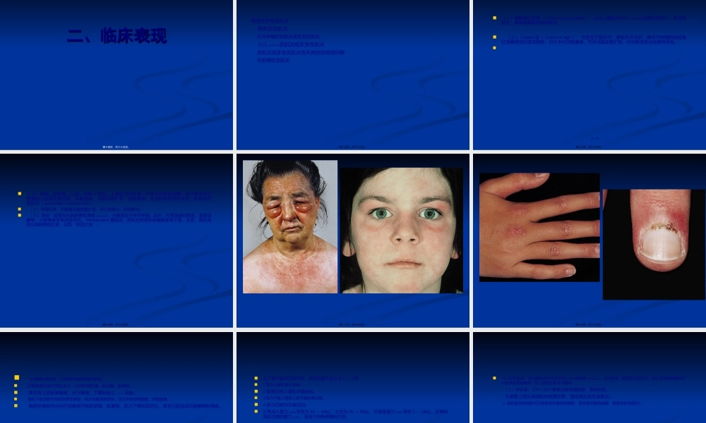 2022年医学专题—皮--肌--炎(1).ppt