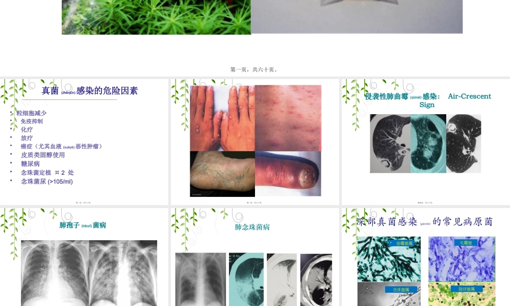 2022年医学专题—真菌药(1).pptx