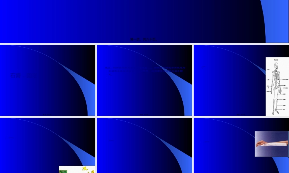 2022年医学专题—石膏、夹板-骨牵引固定技术(1).ppt