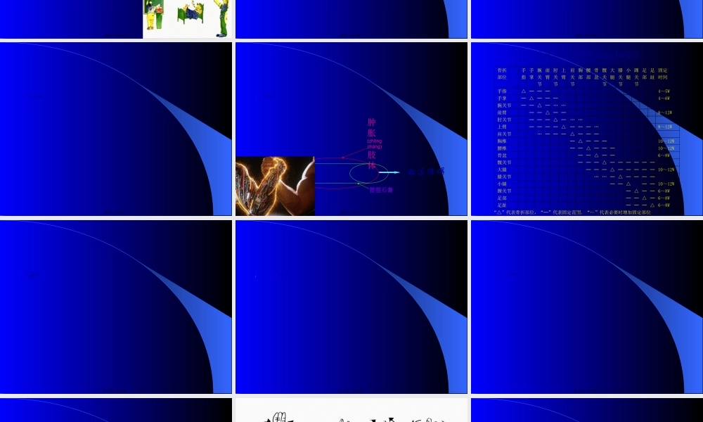 2022年医学专题—石膏、夹板-骨牵引固定技术(1).ppt