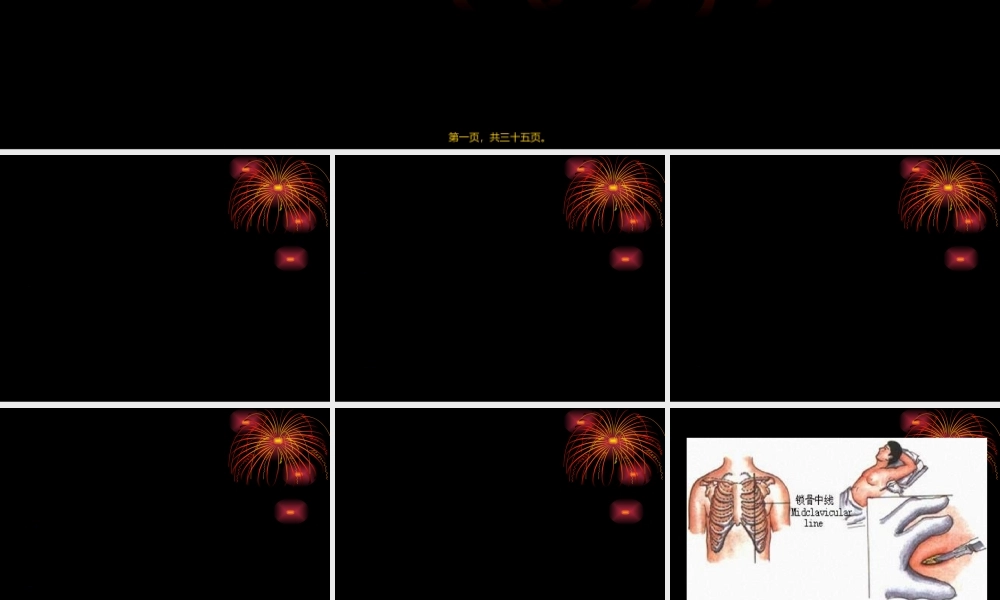 2022年医学专题—胸腔闭式引流术及注意事项-ppt..(1).ppt