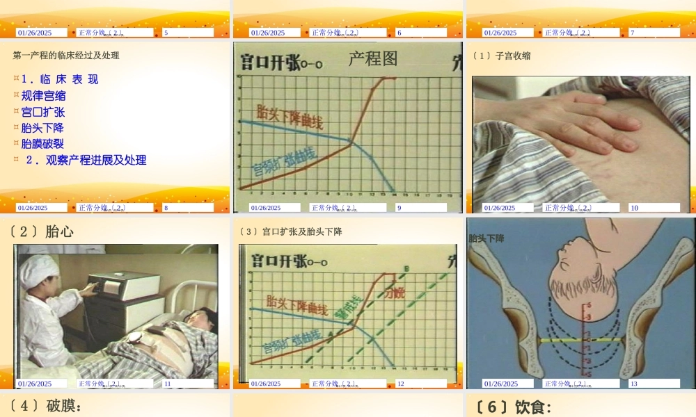 产程经过及处理(1).pptx