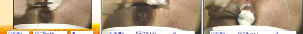 产程经过及处理(1).pptx