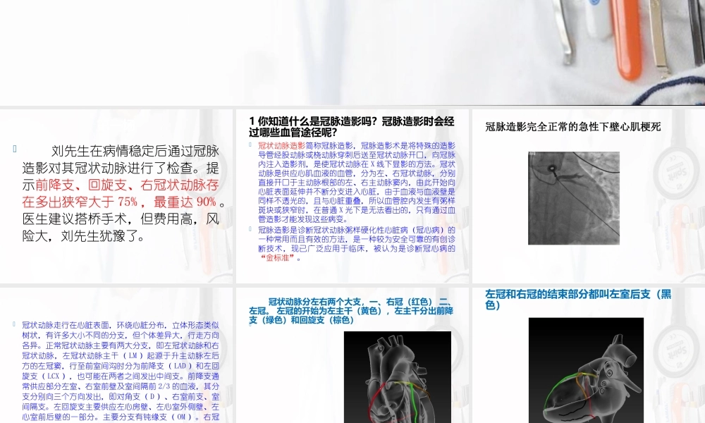 冠心病搭桥手术(1).ppt