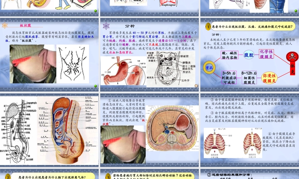 局解病例分析0(1).ppt