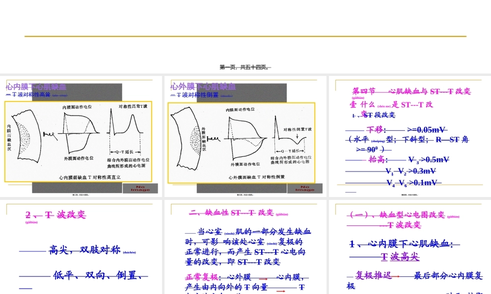 2022年医学专题—心肌缺血、梗塞(1).ppt