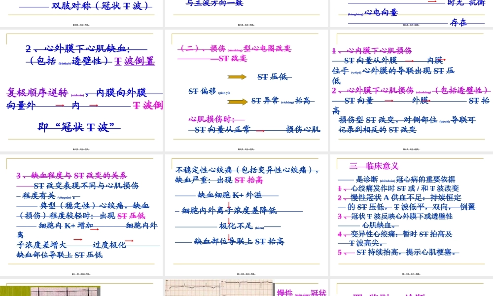 2022年医学专题—心肌缺血、梗塞(1).ppt